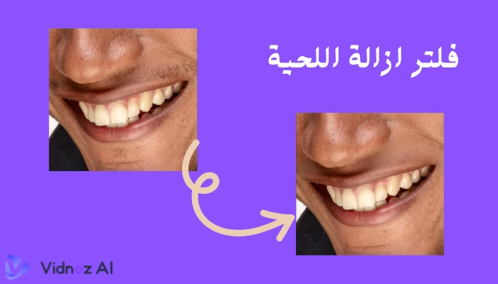 فلتر ازالة اللحية